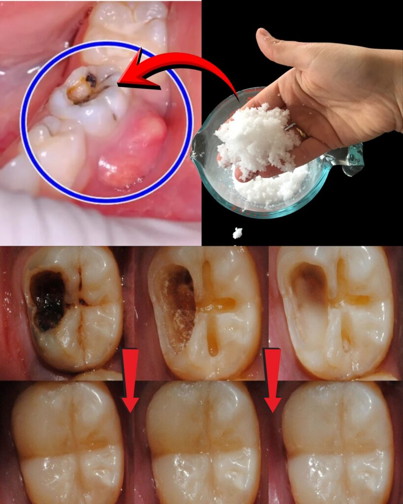 Keep These Tips in Mind to Avoid Visiting the Dentist: How to Naturally Support Early Cavity Repair