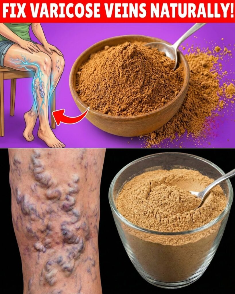 Varicose Veins Making Your Legs Ache? This Horse Chestnut Remedy Might Offer Real Relief
