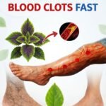 Top Herbs That Dissolve Deadly Blood Clots in Your Legs (And Save Lives You Never Knew Were at Risk)