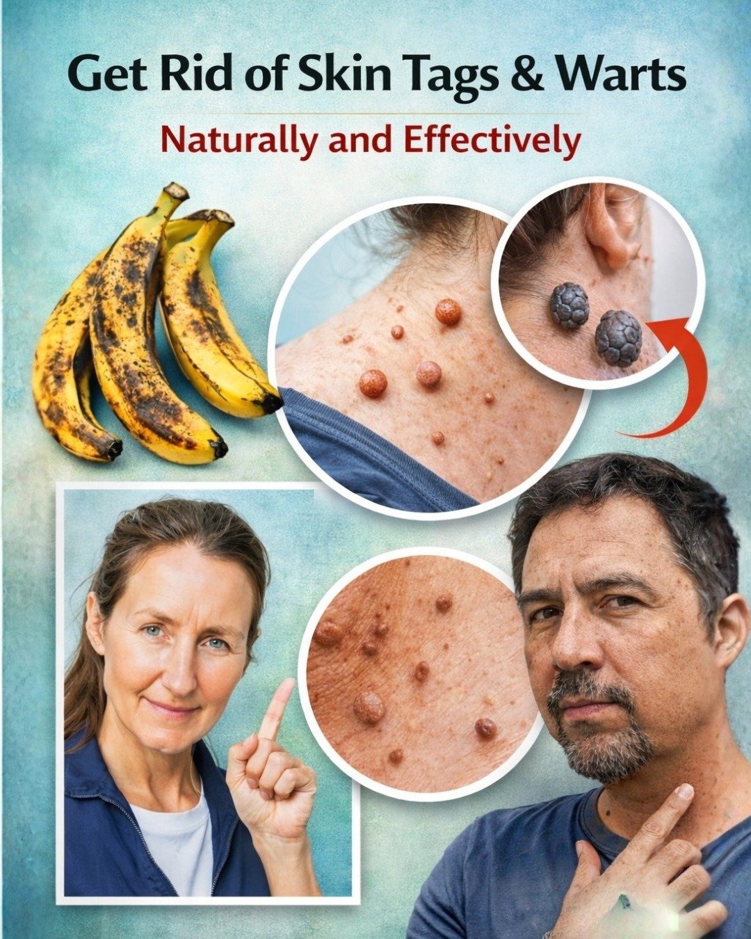 How to Safely Reduce the Appearance of Skin Tags and Warts: What Really Helps