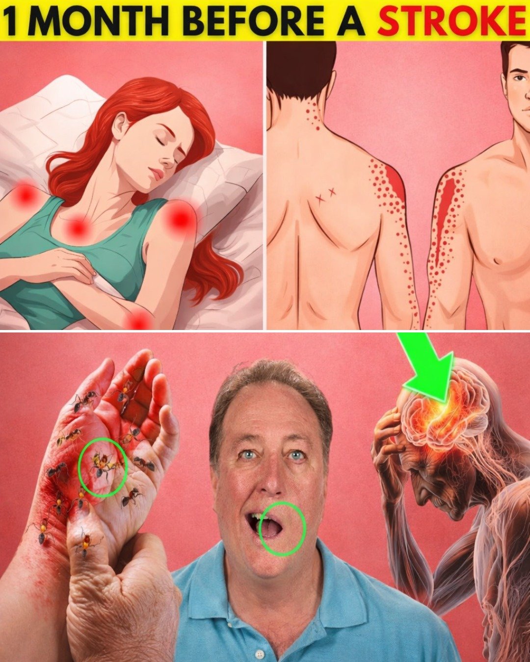 9 Early Signs of Stroke That Can Appear a Week Before: What Seniors Need to Know