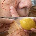 How to Fade Age Spots Naturally with Lemon Juice: Safe Home Tips That Actually Work