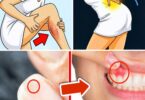 7 Silent Body Signs That Could Warn of Serious Illness