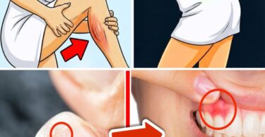 7 Silent Body Signs That Could Warn of Serious Illness