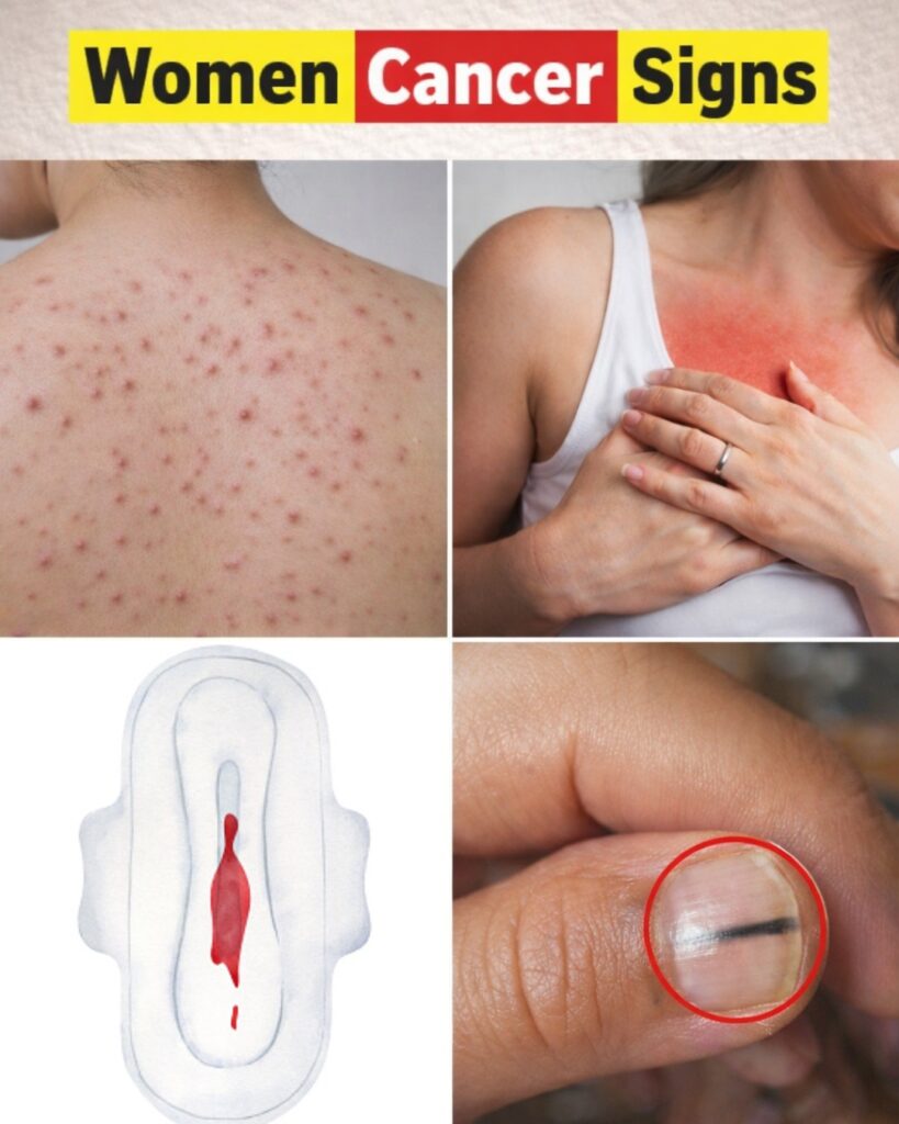 14 Red Flags: Visible Cancer Signs Most Women Accidentally Ignore