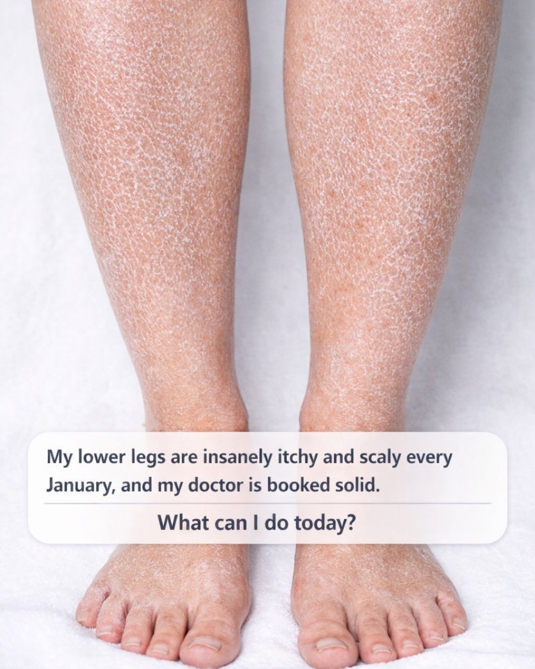 My Lower Legs Are Insanely Itchy and Scaly Every January — What Can I Do Today?
