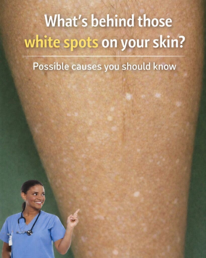 What’s Behind Those White Spots on Your Skin?