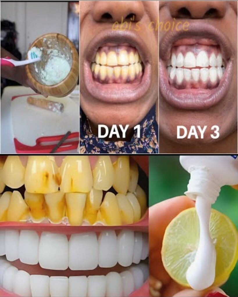 Brighten Your Smile Quickly: Simple Home Teeth Whitening Tricks in Minutes