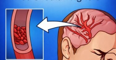 Signs of magnesium deficiency and foods to boost your levels