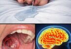 8 Conditions Linked to Drooling While Sleeping You Should Get Checked