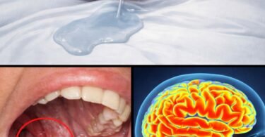 8 Conditions Linked to Drooling While Sleeping You Should Get Checked