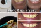 In Just 2 Minutes, Remove 10 Years of Teeth Stains – The Natural Whitener That Actually Works