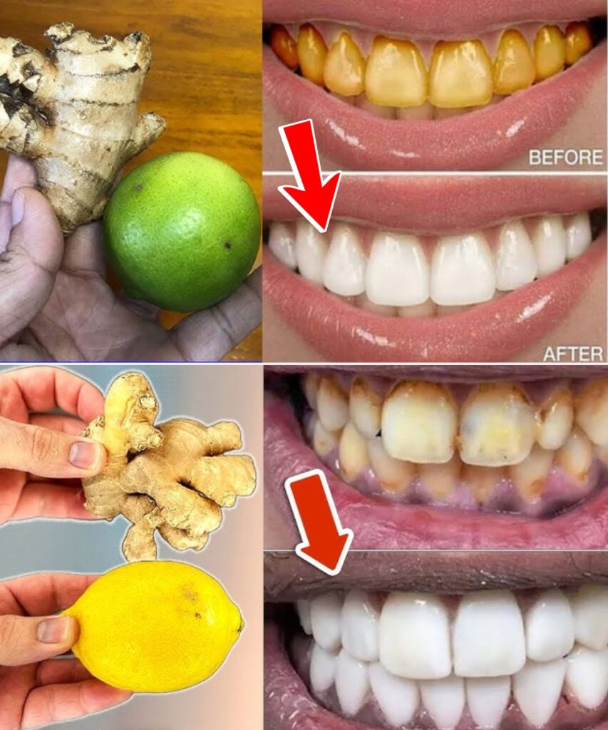 In just 2 minutes YELLOW dirty teeth become milky WHITE and shiny