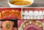 Home Teeth Whitening: Get Whiter Teeth in Just 2 Minutes!
