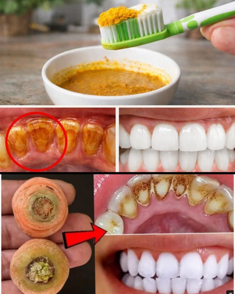 Home Teeth Whitening: Get Whiter Teeth in Just 2 Minutes!