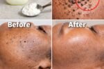 Those Stubborn Little White Bumps: Understanding Milia and Safe Ways to Improve Your Skin’s Appearance
