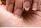 Brittle Nails? 10 Hidden Causes Your Body Is Desperately Trying to Tell You About – And How to Fix Them Fast