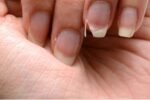 Brittle Nails? 10 Hidden Causes Your Body Is Desperately Trying to Tell You About – And How to Fix Them Fast