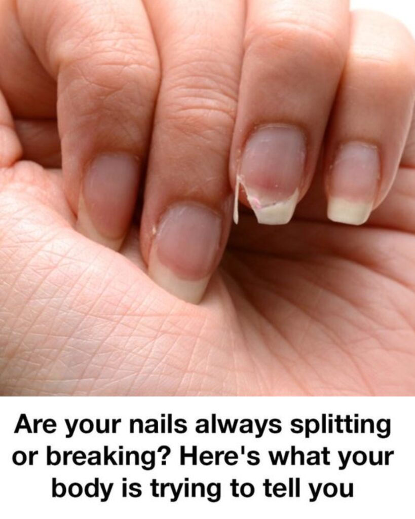 Brittle Nails? 10 Hidden Causes Your Body Is Desperately Trying to Tell You About – And How to Fix Them Fast