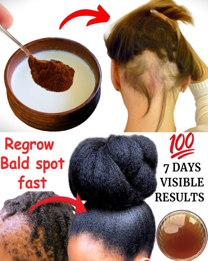 Add This Simple Coffee Mix to Your Shampoo and Watch Your Hair Grow Thicker & Fuller – Naturally!