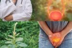 The Best Herbs To TREAT Enlarged Prostate (BPH) – Nature’s Hidden Allies You’re Probably Overlooking