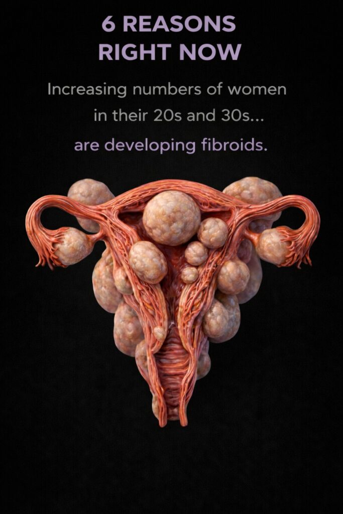 6 Reasons Why More Women in Their 20s and 30s May Be Developing Fibroids
