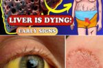 17 Critical Signs Your Liver May Be in Trouble (And How to Turn It Around Naturally Before It’s Too Late)