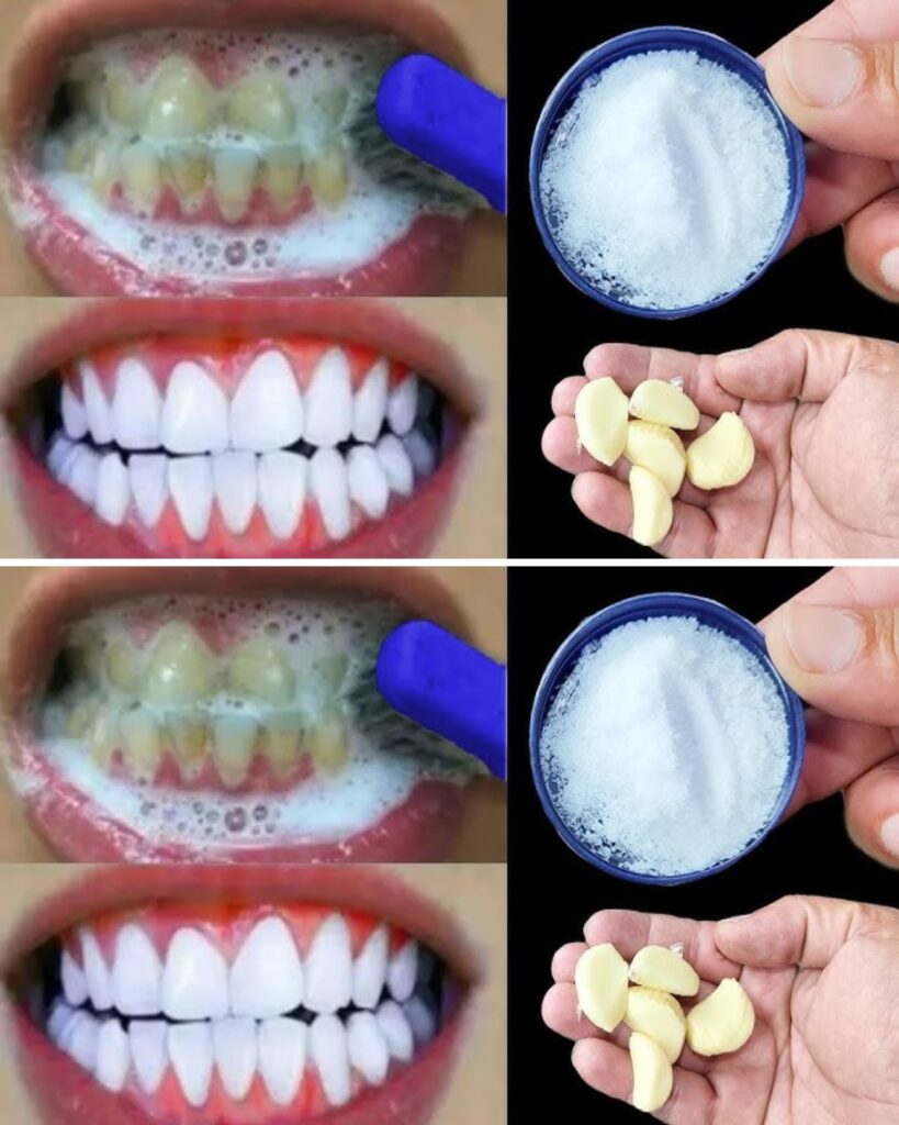 Brighten Your Smile Quickly: Simple Home Teeth Whitening Tricks in Minutes