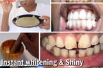 How to Naturally Whiten Yellow Teeth at Home: The Powerful Banana-Ginger-Lemon Secret Thousands Are Raving About