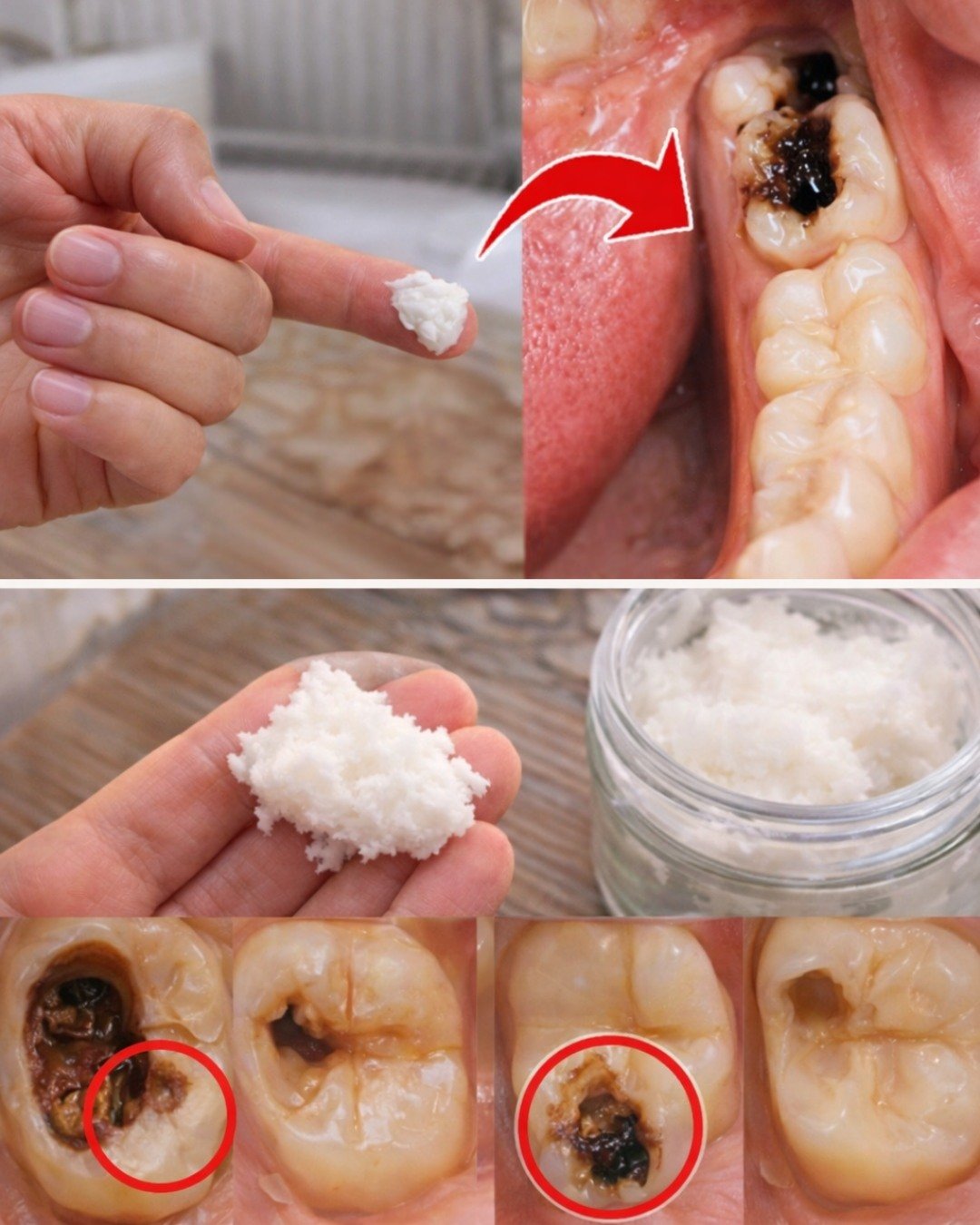 Simple Natural Tips to Keep Your Teeth Healthy: 5 Powerful Home Remedies That May Help Prevent Cavities and Reduce Dental Visits