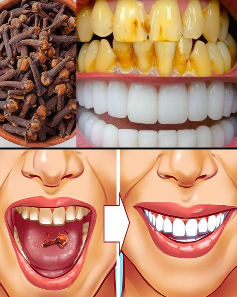 9 Natural Ways to Help Remove Plaque & Reduce Tartar Buildup