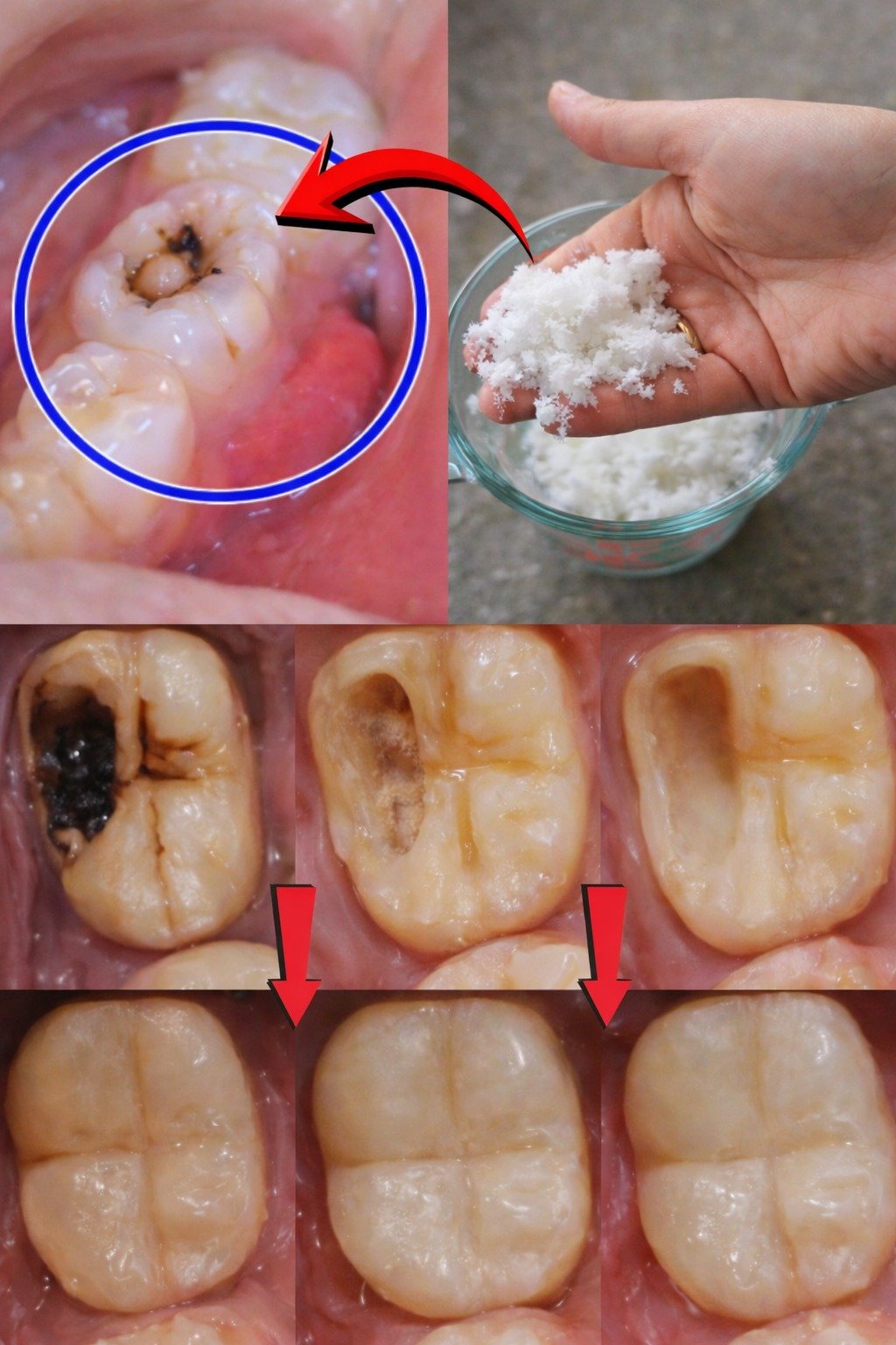 Keep These Tips in Mind to Avoid Visiting the Dentist: How to Naturally Support Early Cavity Repair