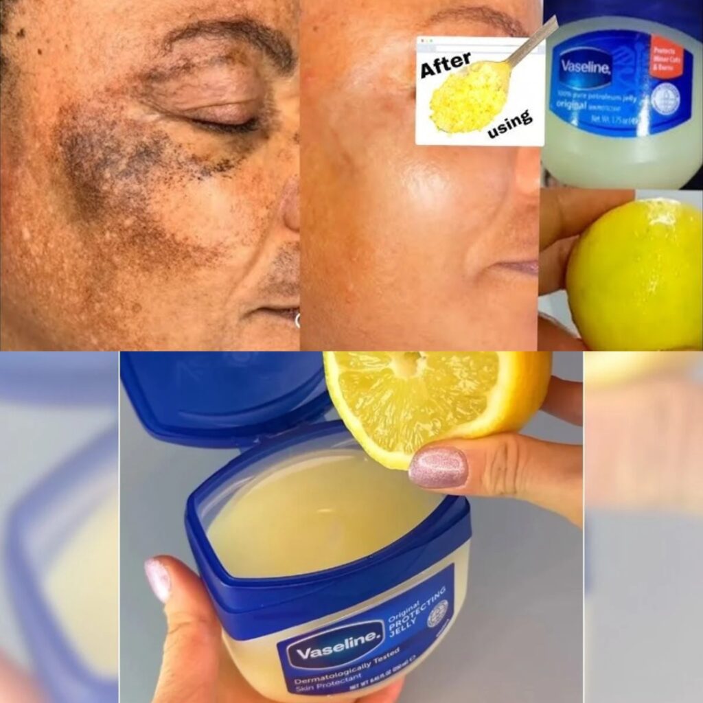 How to apply vaseline and lemon on face | Apply vaseline on your skin and see the magic