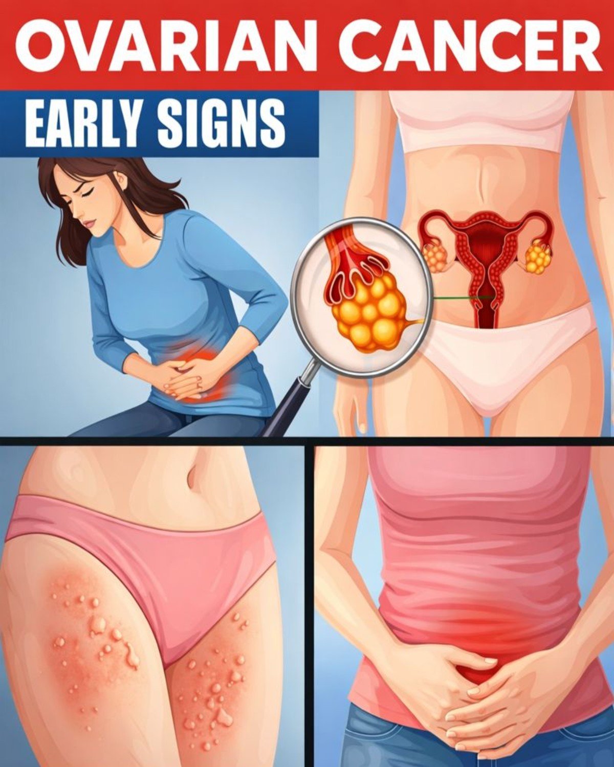 8 Signs of Ovarian Cancer Every Woman Should Watch For – Knowledge That Could Make a Difference