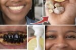 How to Naturally Whiten Yellow Teeth at Home: The Powerful Banana-Ginger-Lemon Secret Thousands Are Raving About