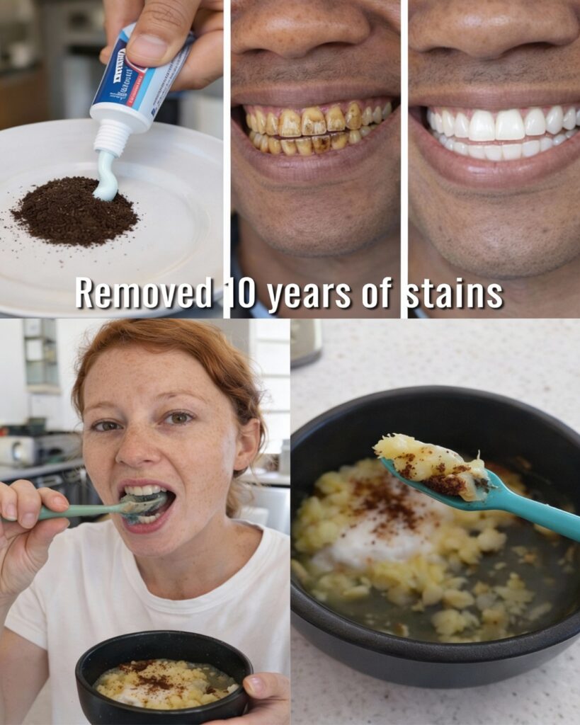 Whiten Your Teeth Naturally in Minutes: The Banana Peel Paste Everyone’s Trying