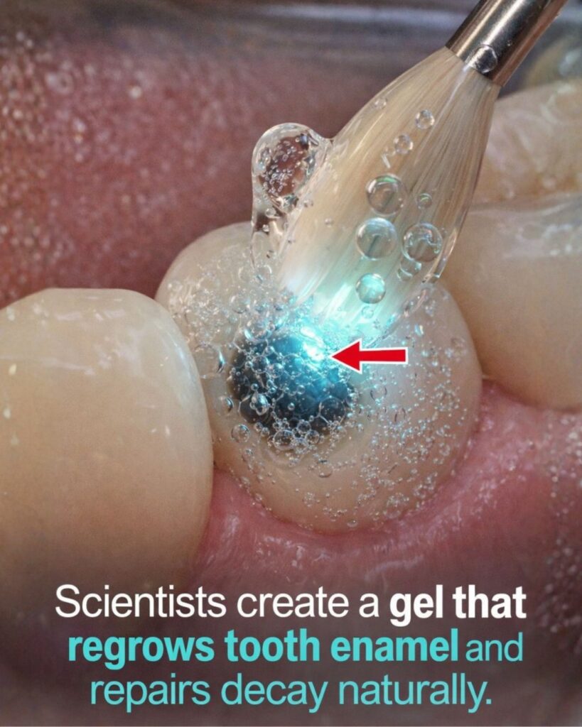 A Promising New Discovery: Could a Gel Help Restore Tooth Enamel Naturally?