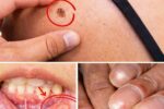 14 Warning Signs of Cancer You Should Never Ignore for Early Awareness
