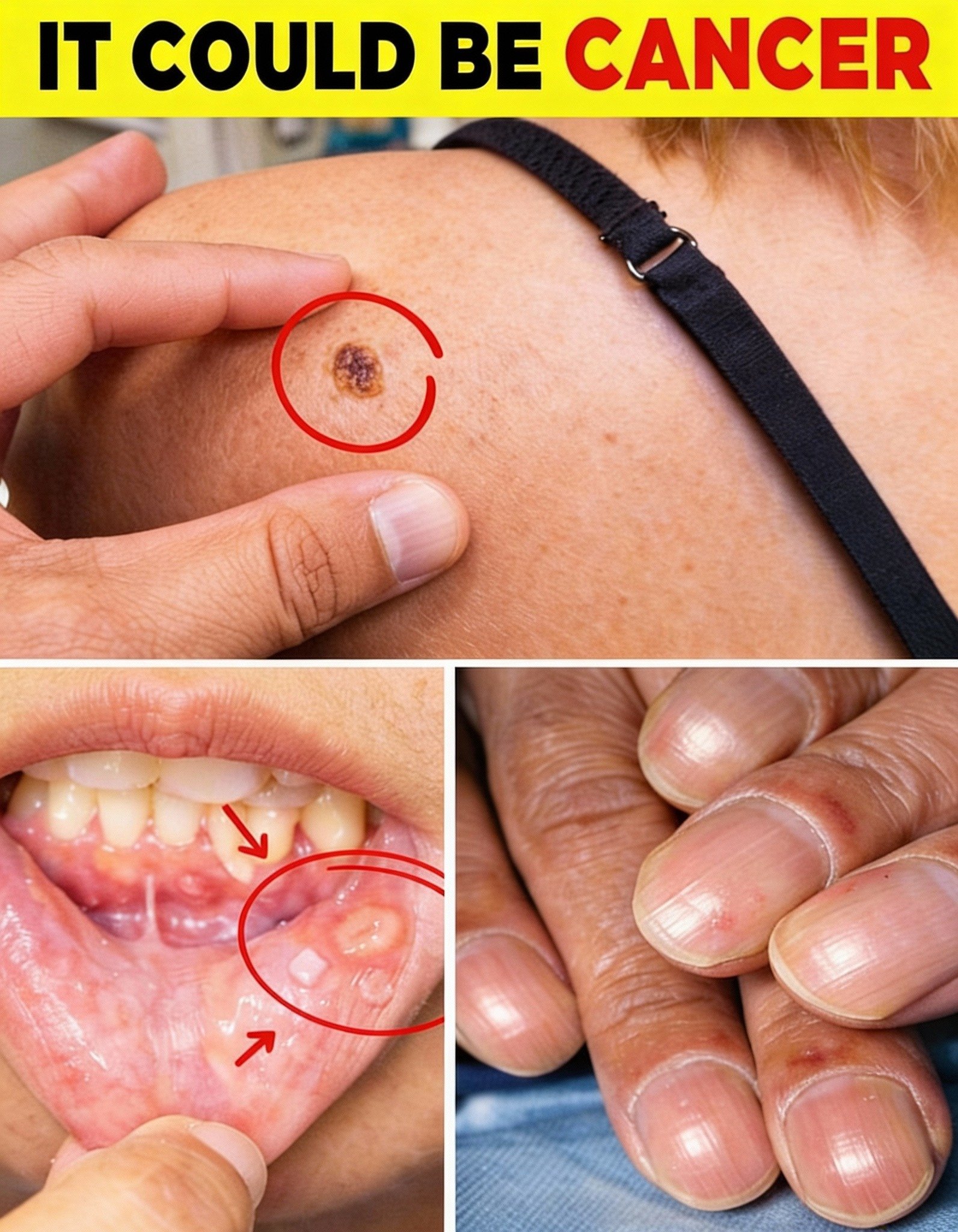 14 Warning Signs of Cancer You Should Never Ignore for Early Awareness