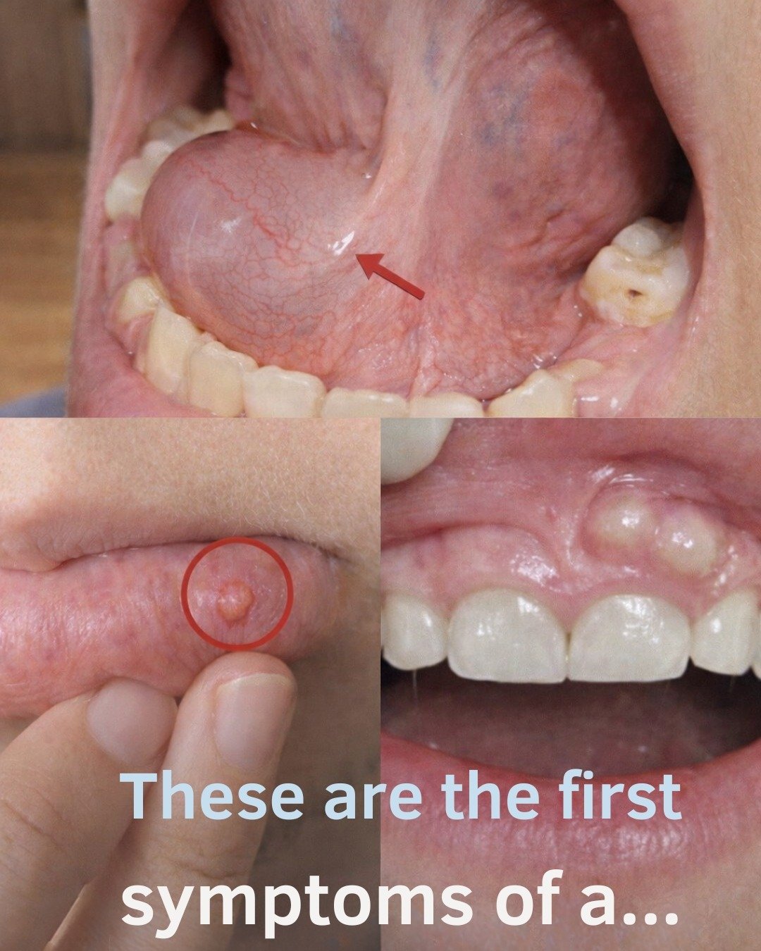 7 Early Signs of Oral Cancer You Should Never Ignore