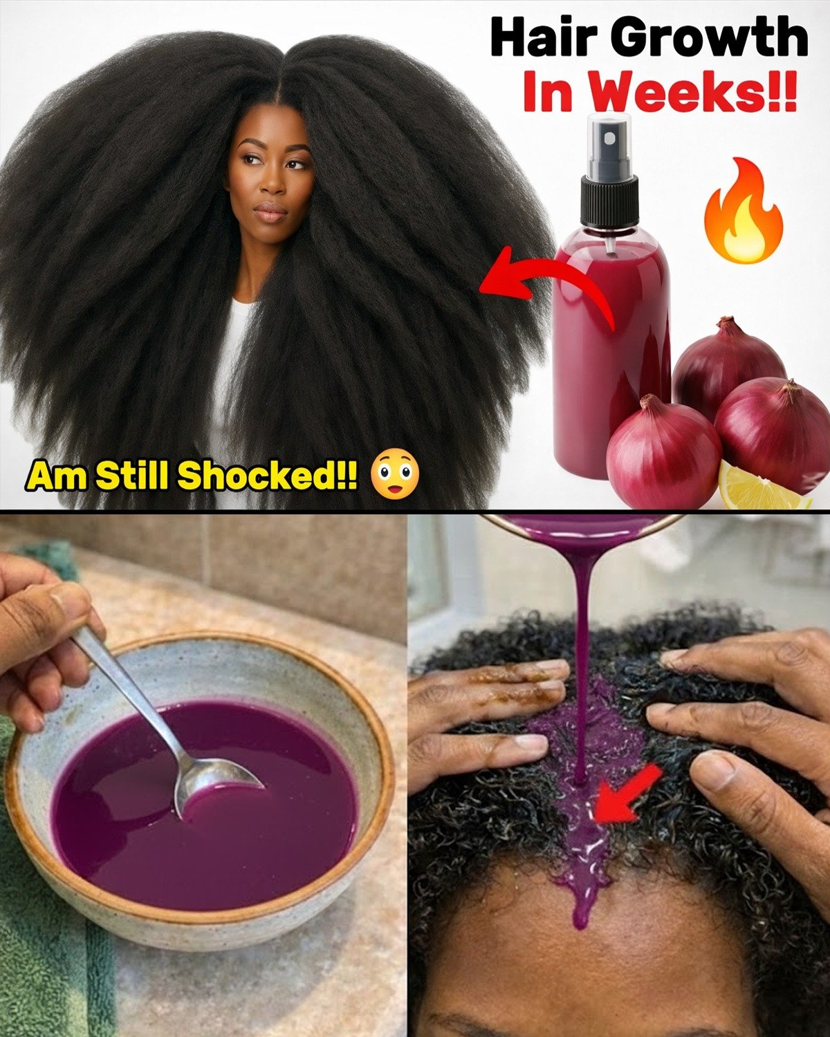 Use This Daily & Watch Your Hair Grow Thicker, Fuller, and Longer in Weeks – The Onion-Lime Secret Millions Are Discovering