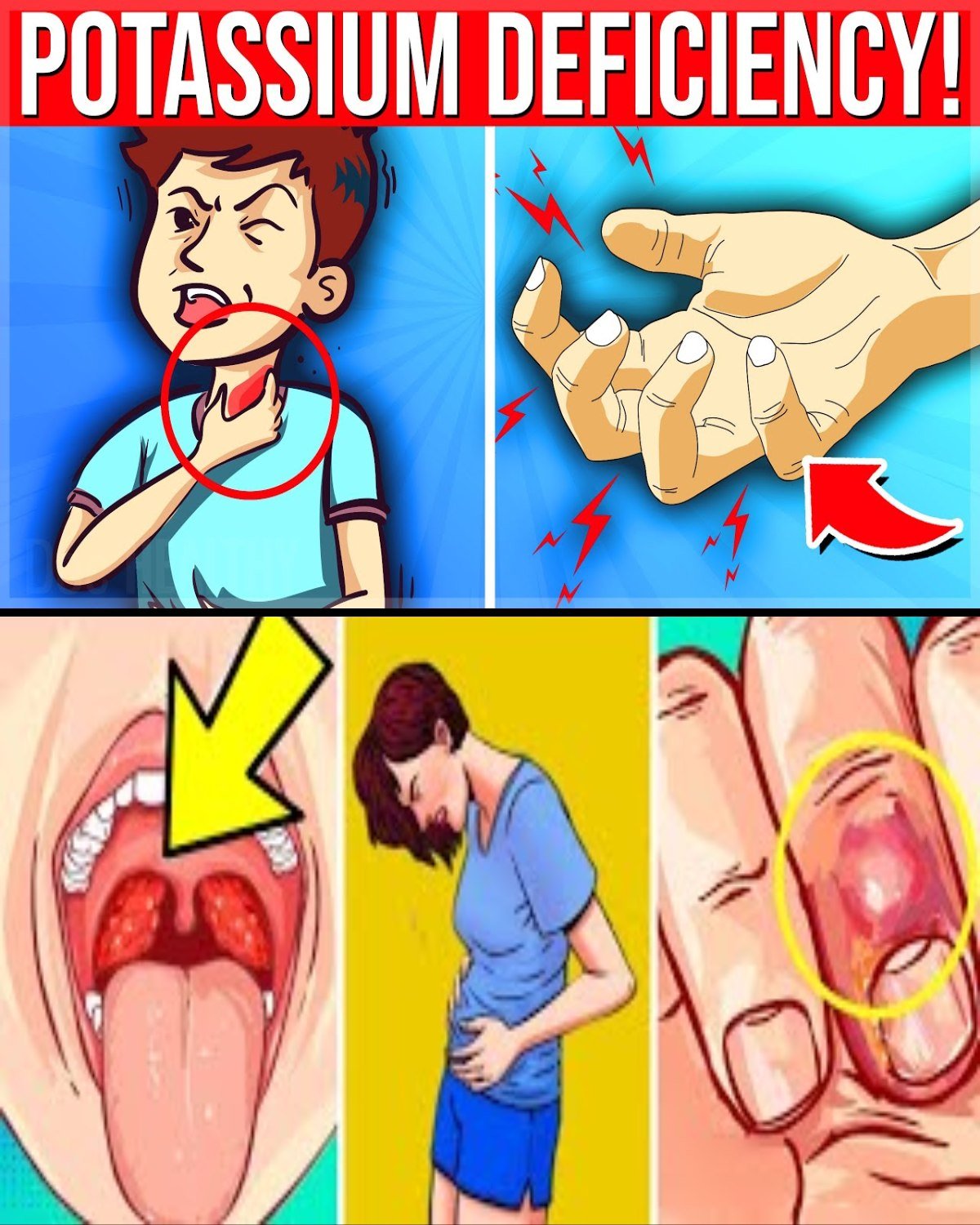 You’re Potassium Deficient If You Have THESE 11 Warning Signs (Hypokalemia)