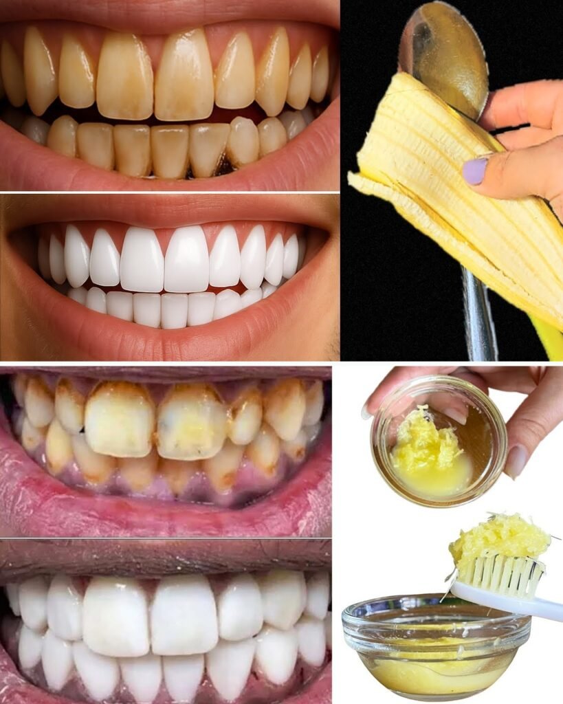 Natural Ways to Whiten Teeth Fast – Safe Home Remedies That Actually Work