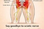 Quick Relief from Sciatica Discomfort: Easy At-Home Stretches to Try Today