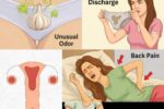 9 Early Warning Signs of Cervical Cancer Most Women Overlook—And Why Acting Now Saves Lives