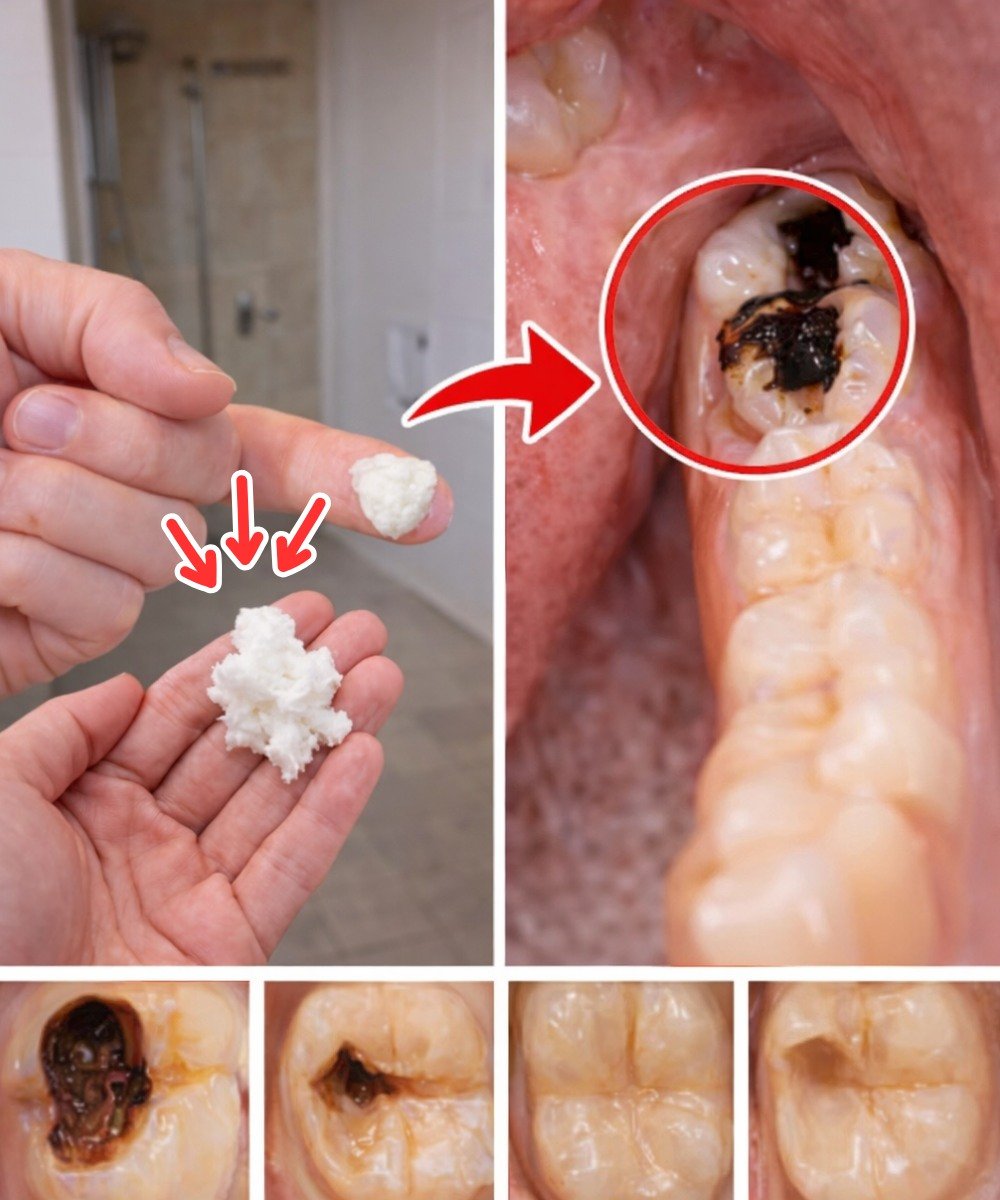 Simple Natural Tips to Keep Your Teeth Healthy: 5 Powerful Home Remedies That May Help Prevent Cavities and Reduce Dental Visits