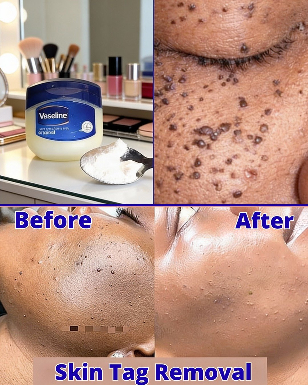 Discovering Milia: Tips to Understand Small White Bumps and Ways to Enhance Skin Appearance Naturally