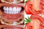 The “Red Glow” Brightener: Why Tomato and Lemon Can Whiten Teeth in Minutes