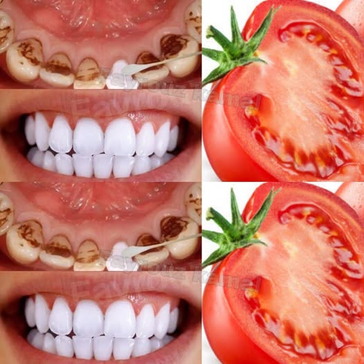 The “Red Glow” Brightener: Why Tomato and Lemon Can Whiten Teeth in Minutes