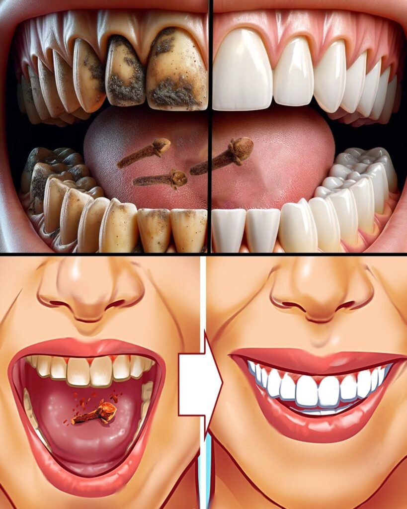 9 Natural Ways to Remove Plaque & Tartar Buildup – And Keep Your Smile Bright